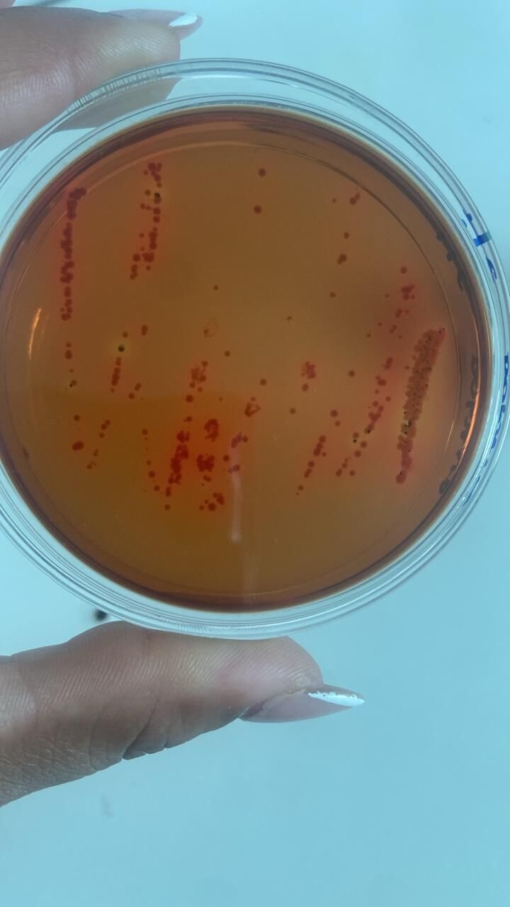 Placa de Petri com colônias de bactérias em análise microbiológica de alimentos